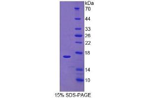 SDS-PAGE analysis of Human RalA Binding Protein 1 Protein. (RALBP1 蛋白)