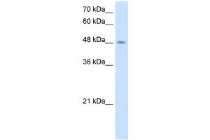 TMPRSS11D antibody used at 2. (TMPRSS11D 抗体  (N-Term))