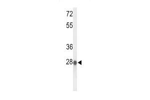 Western blot analysis of ABHDB Antibody (Center) (ABIN653369 and ABIN2842841) in MCF-7 cell line lysates (35 μg/lane). (ABHD11 抗体  (AA 176-205))