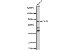 Western blot analysis of extracts of HepG2 cells, using CRNN antibody (ABIN6127877, ABIN6139056, ABIN6139057 and ABIN6224784) at 1:1000 dilution. (CRNN 抗体  (AA 396-495))