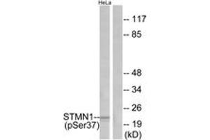 Western blot analysis of extracts from HeLa cells treated with nocodazole, using Stathmin 1 (Phospho-Ser37) Antibody. (Stathmin 1 抗体  (pSer38))