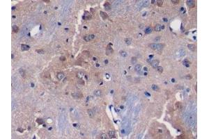 Detection of DKK3 in Rat Cerebrum Tissue using Polyclonal Antibody to Dickkopf Related Protein 3 (DKK3) (DKK3 抗体  (AA 41-348))
