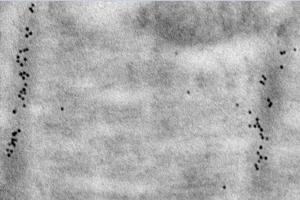 Immunoelectron microscopy analysis of LR white resin-embedded mouse heart using alpha Actinin 2 (ABIN7075510) at dilution of 1: 50. (Sarcomeric alpha Actinin 抗体)