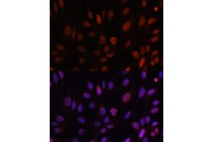 Immunofluorescence analysis of U-2 OS cells using HOXB1 antibody (ABIN6128032, ABIN6141942, ABIN6141943 and ABIN6222309) at dilution of 1:100. (HOXB1 抗体  (AA 35-180))