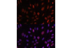 Immunofluorescence analysis of U-2 OS cells using HOXB1 antibody (ABIN6128032, ABIN6141942, ABIN6141943 and ABIN6222309) at dilution of 1:100. (HOXB1 抗体  (AA 35-180))