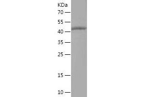 Western Blotting (WB) image for Tripartite Motif Containing 15 (TRIM15) (AA 5-215) protein (His-IF2DI Tag) (ABIN7284075) (TRIM15 Protein (AA 5-215) (His-IF2DI Tag))