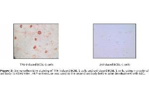 Image no. 1 for anti-KSHV K8 alpha antibody (ABIN478368) (KSHV K8 alpha 抗体)