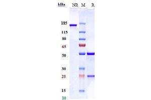 Anti-AXL / UFO Reference Antibody (ORY012) on SDS-PAGE under reducing (R) condition.