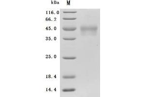 (Tris-Glycine gel) Discontinuous SDS-PAGE (reduced) with 5 % enrichment gel and 15 % separation gel.