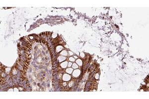 ABIN6272885 at 1/100 staining Mouse colon tissue by IHC-P. (Pallidin 抗体  (C-Term))