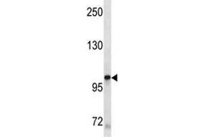 KIT antibody western blot analysis in A549 lysate (KIT 抗体)
