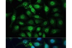 Immunofluorescence analysis of HeLa cells using ZWINT Polyclonal Antibody at dilution of 1:100 (40x lens). (ZWINT 抗体)