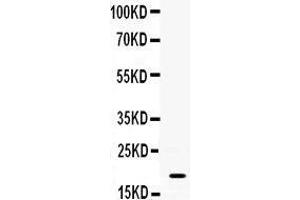 Observed bind size: 19KD (S100A8 抗体  (AA 2-89))