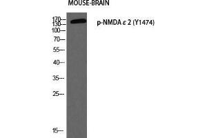 Western Blot (WB) analysis of Mouse Brain using p-NMDAepsilon2 (Y1474) antibody. (NMDA epsilon 2 (pTyr1474) 抗体)