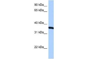 RPLP0 antibody used at 0. (RPLP0 抗体  (N-Term))