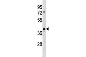 UCHL5 antibody western blot analysis in NCI-H460 lysate.