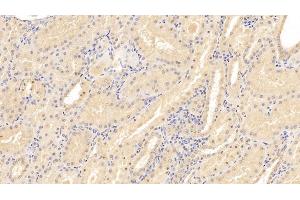 Detection of CD40L in Human Kidney Tissue using Monoclonal Antibody to Cluster Of Differentiation 40 Ligand (CD40L) (CD40 Ligand 抗体  (AA 180-261))