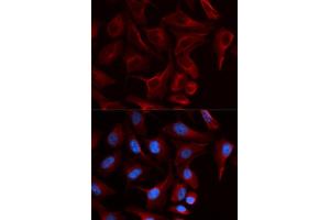 Immunofluorescence (IF) image for anti-Plakophilin 2 (PKP2) antibody (ABIN1876693) (Plakophilin 2 抗体)