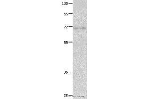 Western blot analysis of Human fetal lung tissue  , using IGF2BP1 Polyclonal Antibody at dilution of 1:500 (IGF2BP1 抗体)
