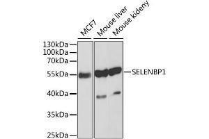 Western blot analysis of extracts of various cell lines, using SELENBP1 antibody. (SELENBP1 抗体)