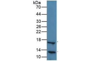 WB of Protein Standard: different control antibodies against Highly purified E.