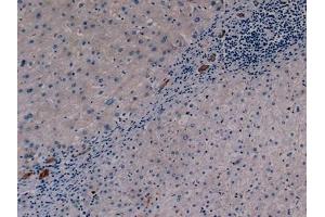 Detection of CK19 in Human Liver Tissue using Monoclonal Antibody to Cytokeratin 19 (CK19) (Cytokeratin 19 抗体  (AA 127-322))
