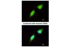 ICC/IF Image Immunofluorescence analysis of paraformaldehyde-fixed HeLa, using NADE, antibody at 1:200 dilution. (Nerve Growth Factor Receptor (TNFRSF16) Associated Protein 1 (NGFRAP1) (Center) 抗体)
