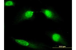 Immunofluorescence of monoclonal antibody to DIAPH3 on HeLa cell. (DIAPH3 抗体  (AA 632-729))