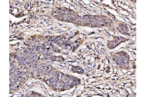 IHC analysis of PAK2 using anti-PAK2 antibody (ABIN7599219). (PAK2 抗体  (AA 1-288))