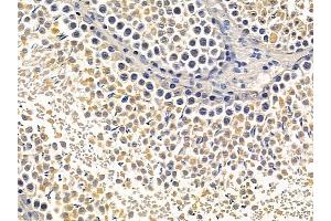 ABIN6257099 and ABIN6275623 at 1/100 staining rat testis tissue by IHC-P. (CCT5 抗体  (Internal Region))