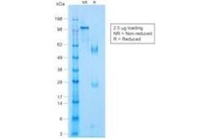 SDS-PAGE Analysis Purified p63 Rabbit Monoclonal Antibody (TP63/1423R). (p63 抗体)