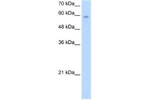 WB Suggested Anti-ARIH2 Antibody Titration:  2. (ARIH2 抗体  (N-Term))