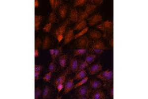 Immunofluorescence (IF) image for anti-SET and MYND Domain Containing 3 (SMYD3) (AA 50-150) antibody (ABIN7270260)