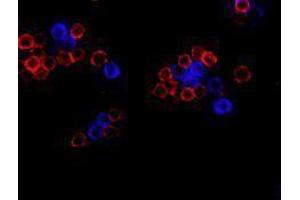 Immunofluorescence (IF) image for anti-CD19 Molecule (CD19) antibody (Alexa Fluor 647) (ABIN2657659) (CD19 抗体  (Alexa Fluor 647))