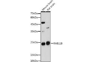 Western blot analysis of extracts of various cell lines, using RB antibody (ABIN7269795) at 1:1000 dilution. (RAB11B 抗体  (AA 130-215))