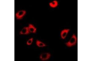 Immunofluorescent analysis of NUP62 staining in Jurkat cells. (NUP62 抗体)