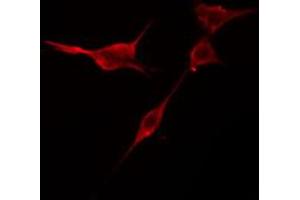 ABIN6274419 staining NIH-3T3 cells by IF/ICC. (TRIM59 抗体  (Internal Region))