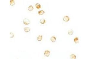 Immunocytochemistry of JMJD3 in K562 cells with JMJD3 antibody at 2. (Kdm6b 抗体  (N-Term))