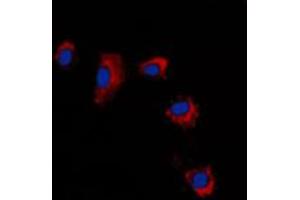 Immunofluorescent analysis of Claudin 2 staining in A431 cells. (Claudin 2 抗体  (C-Term))