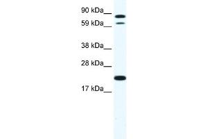 WB Suggested Anti-ZFP287 Antibody Titration:  1. (ZNF287 抗体  (N-Term))