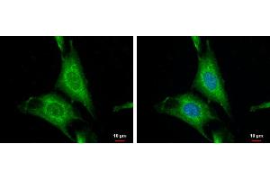 ICC/IF Image WNT10A antibody [N1C1-2] detects WNT10A protein at cytoplasm by immunofluorescent analysis. (WNT10A 抗体  (Center))