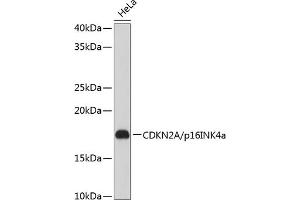 Western Blotting (WB) image for anti-Cyclin-Dependent Kinase Inhibitor 2A (Melanoma, P16, Inhibits CDK4) (CDKN2A) antibody (ABIN6139280)