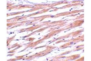 Immunohistochemistry of UNG in human heart tissue with UNG polyclonal antibody  at 2 ug/mL . (UNG 抗体  (C-Term))