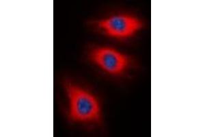 Immunofluorescent analysis of Caldesmon (pS789) staining in HeLa cells. (Caldesmon 抗体  (C-Term, pSer789))