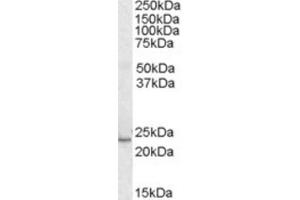 Western Blotting (WB) image for anti-Kruppel-Like Factor 16 (KLF16) (C-Term) antibody (ABIN2465875) (KLF16 抗体  (C-Term))