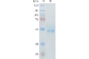 Receptor Tyrosine Kinase-Like Orphan Receptor 2 (ROR2) (AA 34-403) protein (His tag)