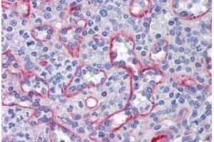 Immunohistochemistry (Formalin-fixed Paraffin-embedded Sections) (IHC (fp)) image for anti-Solute Carrier Family 44, Member 2 (SLC44A2) (AA 123-231) antibody (ABIN574457)