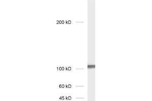 dilution: 1 : 1000; sample: rat hippocampus homogenate (GRIA2 抗体  (AA 278-292))