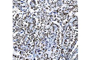 IHC analysis of HDAC2 using anti-HDAC2 antibody (ABIN7601564). (HDAC2 抗体  (AA 387-488))
