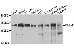 Western blot analysis of extracts of various cells, using PBRM1 antibody. (Polybromo 1 抗体)